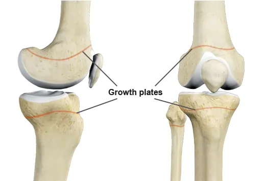Growth Plates What You Need to Know