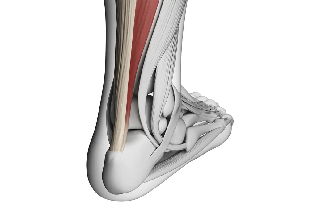 Achilles tendon injury